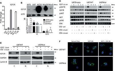 Type 1 Insulin-Like Growth Factor Receptor Nuclear Localization in High-Grade Glioma Cells Enhances Motility, Metabolism, and In Vivo Tumorigenesis